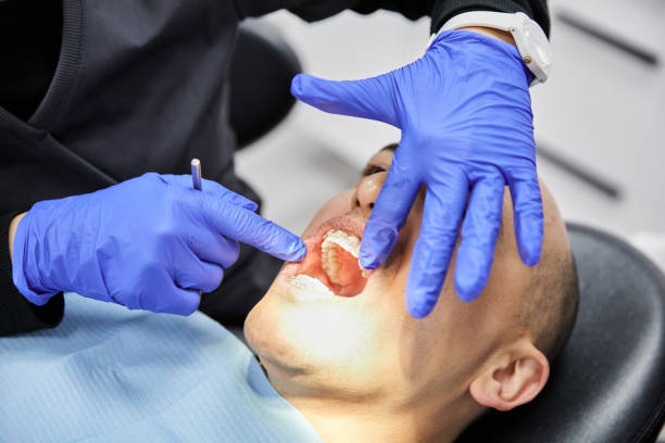 Best Emergency Wisdom Teeth Removal in Northchase, NC